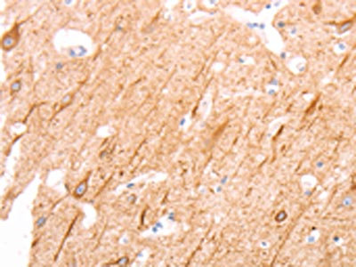 The image on the left is immunohistochemistry of paraffin-embedded Human brain tissue using CSB-PA056378(INA Antibody) at dilution 1/25, on the right is treated with synthetic peptide. (Original magnification: x200)