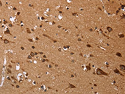 The image on the left is immunohistochemistry of paraffin-embedded Human brain tissue using CSB-PA066402(EDN3 Antibody) at dilution 1/50, on the right is treated with fusion protein. (Original magnification: x200) The image on the left is immunohistochemistry of paraffin-embedded Human brain tissue using CSB-PA066402(EDN3 Antibody) at dilution 1/50, on the right is treated with fusion protein. (Original magnification: x200)