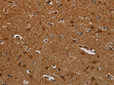The image on the left is immunohistochemistry of paraffin-embedded Human brain tissue using CSB-PA090243(PNOC Antibody) at dilution 1/40, on the right is treated with synthetic peptide. (Original magnification: x200)