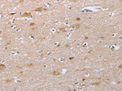 The image on the left is immunohistochemistry of paraffin-embedded Human brain tissue using CSB-PA095524(SAMD9L Antibody) at dilution 1/30, on the right is treated with synthetic peptide. (Original magnification: x200) The image on the left is immunohistochemistry of paraffin-embedded Human brain tissue using CSB-PA095524(SAMD9L Antibody) at dilution 1/30, on the right is treated with synthetic peptide. (Original magnification: x200)