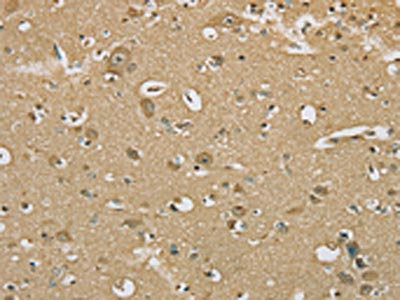 The image on the left is immunohistochemistry of paraffin-embedded Human brain tissue using CSB-PA122539(SERINC1 Antibody) at dilution 1/30, on the right is treated with synthetic peptide. (Original magnification: x200)