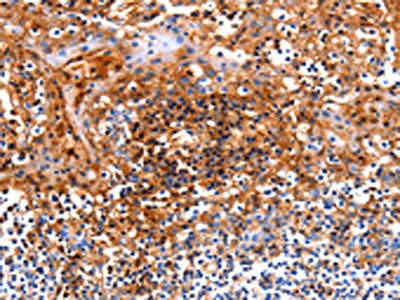 CSB-PA123586