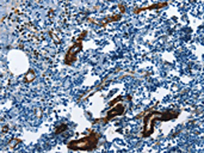 The image on the left is immunohistochemistry of paraffin-embedded Human tonsil tissue using CSB-PA125050(ACTA2 Antibody) at dilution 1/30, on the right is treated with synthetic peptide. (Original magnification: x200)