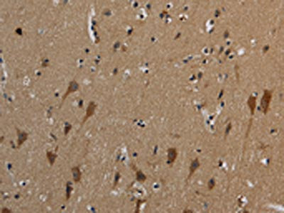 The image on the left is immunohistochemistry of paraffin-embedded Human brain tissue using CSB-PA126539(HSPG2 Antibody) at dilution 1/50, on the right is treated with synthetic peptide. (Original magnification: x200)