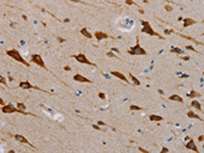 The image is immunohistochemistry of paraffin-embedded Human brain tissue using CSB-PA133615(TAB3 Antibody) at dilution 1/25. (Original magnification: x200)