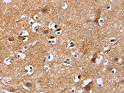 The image on the left is immunohistochemistry of paraffin-embedded Human brain tissue using CSB-PA133797(MAD1L1 Antibody) at dilution 1/25, on the right is treated with fusion protein. (Original magnification: x200)