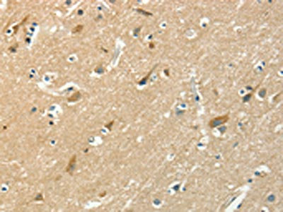 The image on the left is immunohistochemistry of paraffin-embedded Human brain tissue using CSB-PA133826(ASAH2 Antibody) at dilution 1/50, on the right is treated with fusion protein. (Original magnification: x200)