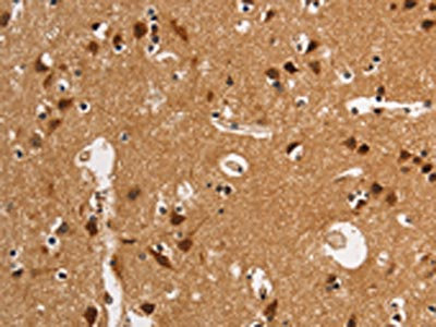 The image on the left is immunohistochemistry of paraffin-embedded Human brain tissue using CSB-PA135409(ANAPC4 Antibody) at dilution 1/50, on the right is treated with synthetic peptide. (Original magnification: x200)