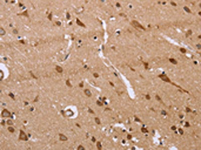 The image on the left is immunohistochemistry of paraffin-embedded Human brain tissue using CSB-PA139252(FAAH2 Antibody) at dilution 1/30, on the right is treated with fusion protein. (Original magnification: x200)