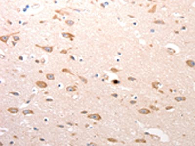 The image on the left is immunohistochemistry of paraffin-embedded Human brain tissue using CSB-PA160889(CDC37 Antibody) at dilution 1/20, on the right is treated with synthetic peptide. (Original magnification: x200)