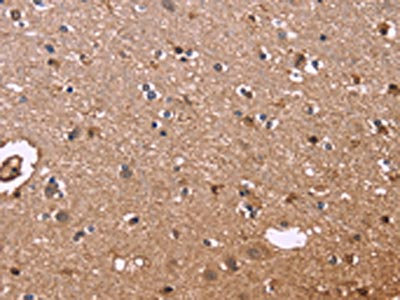 The image on the left is immunohistochemistry of paraffin-embedded Human brain tissue using CSB-PA165136(S100A13 Antibody) at dilution 1/40, on the right is treated with fusion protein. (Original magnification: x200)