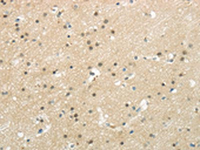 The image on the left is immunohistochemistry of paraffin-embedded Human brain tissue using CSB-PA196402(BAZ1B Antibody) at dilution 1/20, on the right is treated with synthetic peptide. (Original magnification: x200)