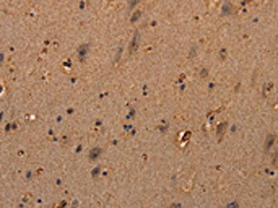 The image on the left is immunohistochemistry of paraffin-embedded Human brain tissue using CSB-PA199023(COL18A1 Antibody) at dilution 1/40, on the right is treated with synthetic peptide. (Original magnification: x200)