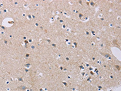 The image on the left is immunohistochemistry of paraffin-embedded Human brain tissue using CSB-PA243594(CD33 Antibody) at dilution 1/40, on the right is treated with fusion protein. (Original magnification: x200)