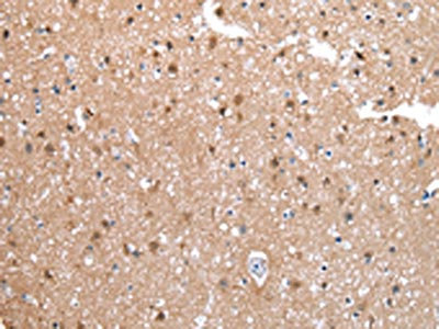 The image on the left is immunohistochemistry of paraffin-embedded Human brain tissue using CSB-PA250029(CXCR4 Antibody) at dilution 1/20, on the right is treated with synthetic peptide. (Original magnification: x200)