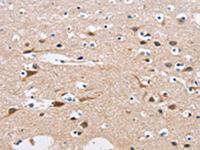 The image on the left is immunohistochemistry of paraffin-embedded Human brain tissue using CSB-PA251074(C3AR1 Antibody) at dilution 1/50, on the right is treated with fusion protein. (Original magnification: x200)