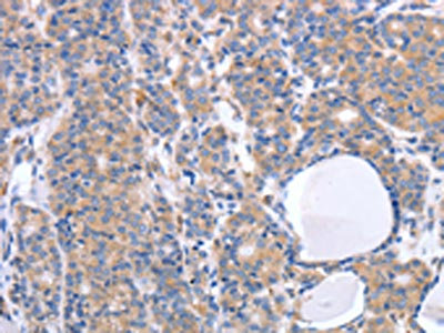 CSB-PA271998