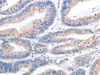 CSB-PA271998