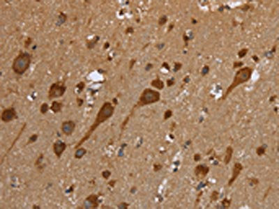 The image on the left is immunohistochemistry of paraffin-embedded Human brain tissue using CSB-PA289988(TRIM29 Antibody) at dilution 1/50, on the right is treated with fusion protein. (Original magnification: x200)