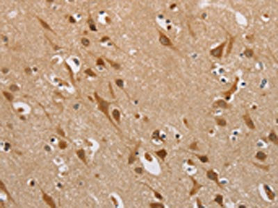 The image on the left is immunohistochemistry of paraffin-embedded Human brain tissue using CSB-PA295249(DDX43 Antibody) at dilution 1/40, on the right is treated with fusion protein. (Original magnification: x200)