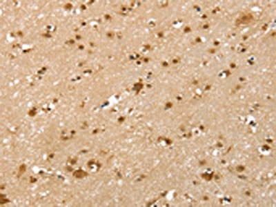 The image on the left is immunohistochemistry of paraffin-embedded Human brain tissue using CSB-PA296253(SLTM Antibody) at dilution 1/40, on the right is treated with synthetic peptide. (Original magnification: x200) The image on the left is immunohistochemistry of paraffin-embedded Human brain tissue using CSB-PA296253(SLTM Antibody) at dilution 1/40, on the right is treated with synthetic peptide. (Original magnification: x200)