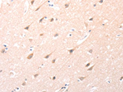 The image on the left is immunohistochemistry of paraffin-embedded Human brain tissue using CSB-PA337817(ANGPTL2 Antibody) at dilution 1/20, on the right is treated with synthetic peptide. (Original magnification: x200)