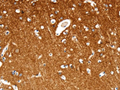 The image on the left is immunohistochemistry of paraffin-embedded Human brain tissue using CSB-PA570132(MAP4K1 Antibody) at dilution 1/30, on the right is treated with synthetic peptide. (Original magnification: x200)