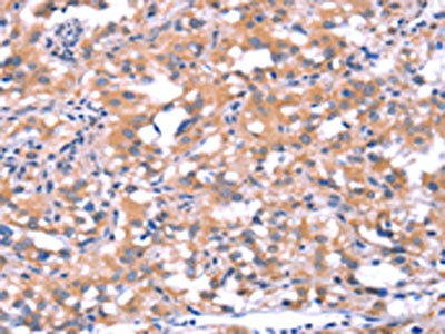 CSB-PA592424
