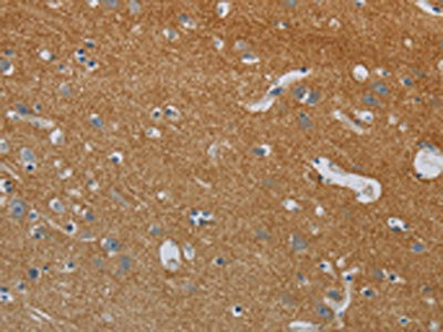 The image on the left is immunohistochemistry of paraffin-embedded Human brain tissue using CSB-PA780265(DPYSL3 Antibody) at dilution 1/20, on the right is treated with synthetic peptide. (Original magnification: x200) The image on the left is immunohistochemistry of paraffin-embedded Human brain tissue using CSB-PA780265(DPYSL3 Antibody) at dilution 1/20, on the right is treated with synthetic peptide. (Original magnification: x200)
