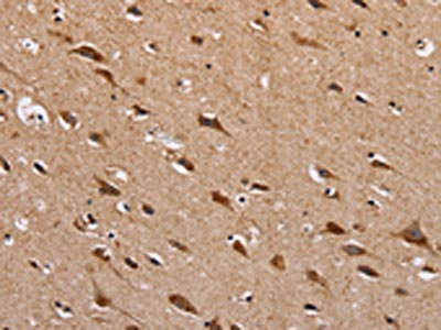 The image on the left is immunohistochemistry of paraffin-embedded Human brain tissue using CSB-PA869025(HTR3C Antibody) at dilution 1/30, on the right is treated with fusion protein. (Original magnification: x200)