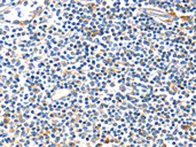 The image on the left is immunohistochemistry of paraffin-embedded Human tonsil tissue using CSB-PA869336(IDE Antibody) at dilution 1/20, on the right is treated with fusion protein. (Original magnification: x200)
