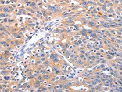 CSB-PA899249