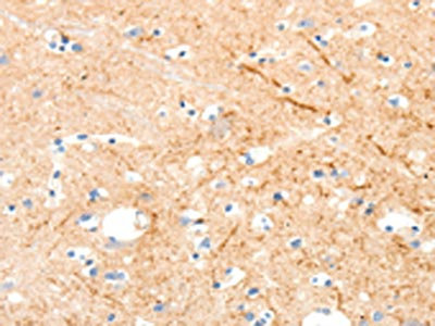 The image on the left is immunohistochemistry of paraffin-embedded Human brain tissue using CSB-PA900670(MAP4K1 Antibody) at dilution 1/30, on the right is treated with synthetic peptide. (Original magnification: x200)