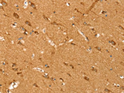 The image on the left is immunohistochemistry of paraffin-embedded Human brain tissue using CSB-PA902433(SIRT4 Antibody) at dilution 1/35, on the right is treated with synthetic peptide. (Original magnification: x200)