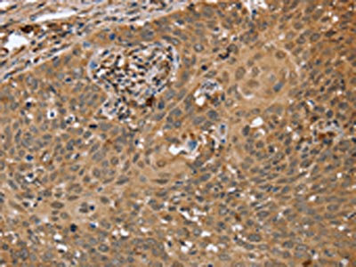 CSB-RA999377A0HU IHC-2