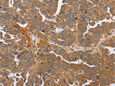 CSB-RA999377A0HU IHC-1