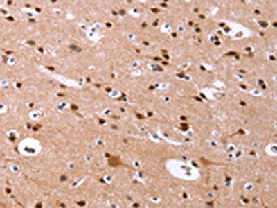 The image on the left is immunohistochemistry of paraffin-embedded Human brain tissue using CSB-PA935129(ID4 Antibody) at dilution 1/40, on the right is treated with synthetic peptide. (Original magnification: x200)