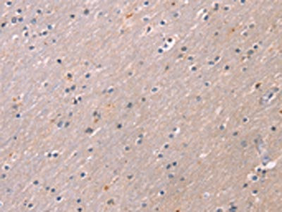 The image on the left is immunohistochemistry of paraffin-embedded Human brain tissue using CSB-PA964419(KCNK3 Antibody) at dilution 1/20, on the right is treated with synthetic peptide. (Original magnification: x200)