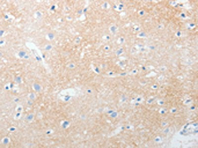 The image on the left is immunohistochemistry of paraffin-embedded Human brain tissue using CSB-PA964902(NOTCH2 Antibody) at dilution 1/30, on the right is treated with synthetic peptide. (Original magnification: X200) The image on the left is immunohistochemistry of paraffin-embedded Human brain tissue using CSB-PA964902(NOTCH2 Antibody) at dilution 1/30, on the right is treated with synthetic peptide. (Original magnification: X200)