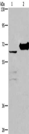 Gel: 10%SDS-PAGE, Lysate: 40 ug, Lane 1-2: 231 cells, mouse kidney tissue, Primary antibody: CSB-PA017354(CHDH Antibody) at dilution 1/400, Secondary antibody: Goat anti rabbit IgG at 1/8000 dilution, Exposure time: 20 seconds