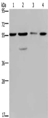 Gel: 8%SDS-PAGE, Lysate: 40 ug, Lane 1-4: Hela cells, 293T cells, A549 cells, HT29 cells, Primary antibody: CSB-PA018458(NUP50 Antibody) at dilution 1/200, Secondary antibody: Goat anti rabbit IgG at 1/8000 dilution, Exposure time: 20 seconds