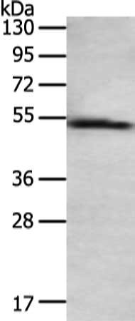 Gel: 8%SDS-PAGE, Lysate: 40 ug, Lane: Human normal liver tissue, Primary antibody: CSB-PA024203(TAT Antibody) at dilution 1/200 dilution, Secondary antibody: Goat anti rabbit IgG at 1/8000 dilution, Exposure time: 3 minutes