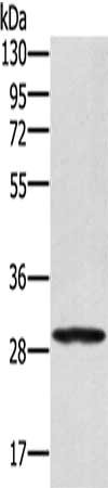 Gel: 8%SDS-PAGE, Lysate: 40 ug, Lane: 293T cells, Primary antibody: CSB-PA025575(EDA2R Antibody) at dilution 1/250, Secondary antibody: Goat anti rabbit IgG at 1/8000 dilution, Exposure time: 10 seconds