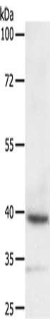 Gel: 10%SDS-PAGE, Lysate: 40 ug, Lane: SKOV3 cells, Primary antibody: CSB-PA026205(DTX3 Antibody) at dilution 1/200, Secondary antibody: Goat anti rabbit IgG at 1/8000 dilution, Exposure time: 10 minutes