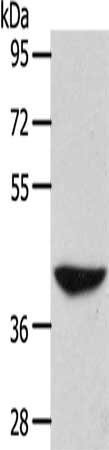 Gel: 10%SDS-PAGE, Lysate: 40 ug, Lane: 293T cells, Primary antibody: CSB-PA027485(ADH1B Antibody) at dilution 1/450, Secondary antibody: Goat anti rabbit IgG at 1/8000 dilution, Exposure time: 10 minutes
