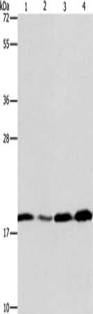Gel: 10%SDS-PAGE, Lysate: 40 ug, Lane 1-4: A431 cells, human liver cancer tissue, 231 cells, human fetal liver tissue, Primary antibody: CSB-PA029843(ARF6 Antibody) at dilution 1/200, Secondary antibody: Goat anti rabbit IgG at 1/8000 dilution, Exposure time: 20 seconds