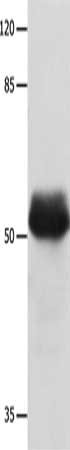 Gel: 8%SDS-PAGE, Lysate: 40 ug, Lane: Hela cells, Primary antibody: CSB-PA029874(MUTYH Antibody) at dilution 1/500, Secondary antibody: Goat anti rabbit IgG at 1/8000 dilution, Exposure time: 1 minute