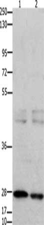 Gel: 10%SDS-PAGE, Lysate: 40 ug, Lane 1-2: 231 cells, mouse testis tissue, Primary antibody: CSB-PA033761(GNRHR Antibody) at dilution 1/650, Secondary antibody: Goat anti rabbit IgG at 1/8000 dilution, Exposure time: 7 seconds Gel: 10%SDS-PAGE, Lysate: 40 ug, Lane 1-2: 231 cells, mouse testis tissue, Primary antibody: CSB-PA033761(GNRHR Antibody) at dilution 1/650, Secondary antibody: Goat anti rabbit IgG at 1/8000 dilution, Exposure time: 7 seconds