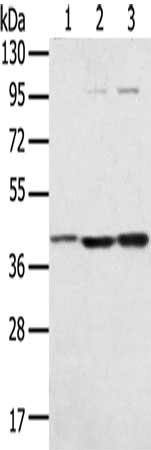 Gel: 8%SDS-PAGE, Lysate: 40 ug, Lane 1-3: Hepg2 cells, TM4 cells, Raw264.7 cells, Primary antibody: CSB-PA041704(STX18 Antibody) at dilution 1/300, Secondary antibody: Goat anti rabbit IgG at 1/8000 dilution, Exposure time: 20 seconds