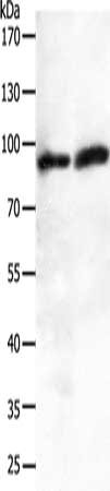 Gel: 10%SDS-PAGE, Lysate: 50 ug, Lane 1-2: A549 cells, human fetal brain tissue, Primary antibody: CSB-PA044408(JUP Antibody) at dilution 1/200, Secondary antibody: Goat anti rabbit IgG at 1/8000 dilution, Exposure time: 2 minutes